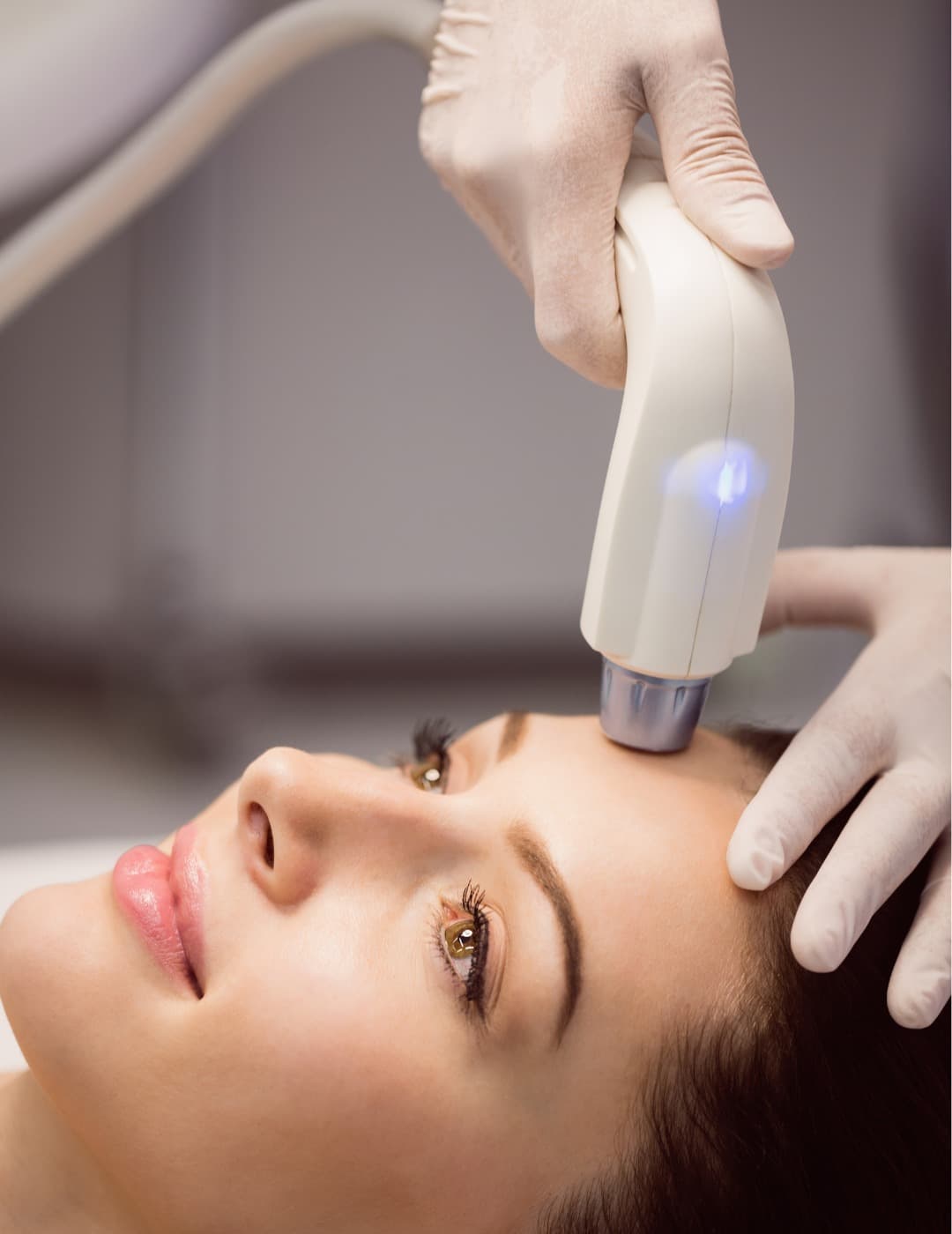 Radiofrecuencia Facial